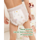 Iconic Babycare Signature Day & Night Baby Diaper Pants M44/L38/XL32/XXL28 (Pack)