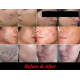 Alexis Pure Toco-Liftonin ARB 100% All-Natural Herbal Face Serum, Anti-Aging, Acne Treatment, Pores Minimizer 30ml (Bu 3 Free 1)
