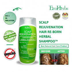 EcoHerbs Scalp Rejuvenation Stops Hair loss Herbal Shampoo, Dandruff, Oily/Itchy/Dry/Flaky Scalp, Lice Problems (150ml)