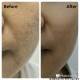 Remdii Protect & Repair Daily Resurging Face Serum (30ml) for Sensitive Skin, Eczema and Psoriasis
